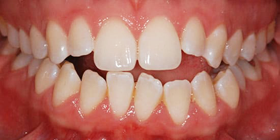 Before Image