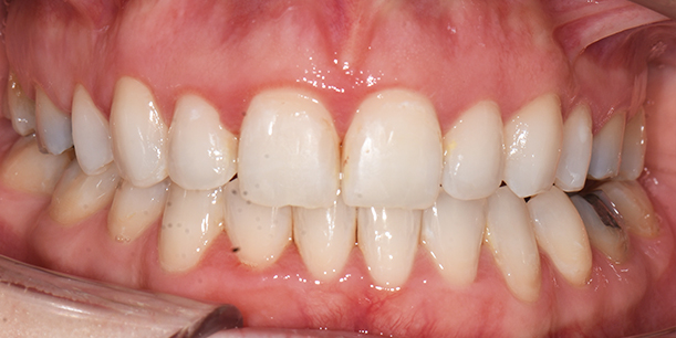 After Image