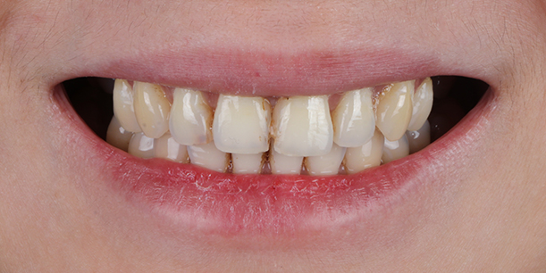 Before Image