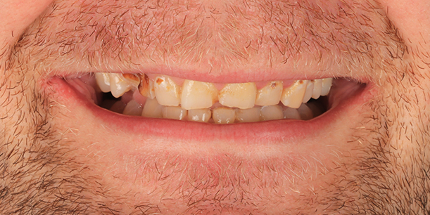 Before Image