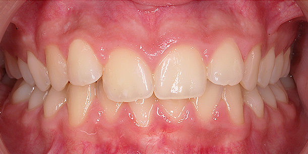 Before Image