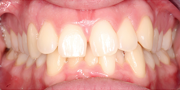 Before Image