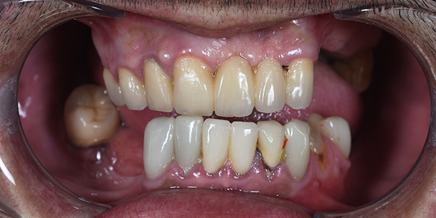 Before Image