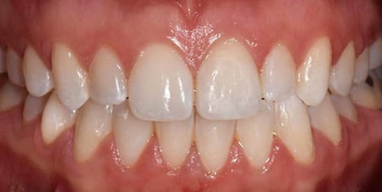 After Image