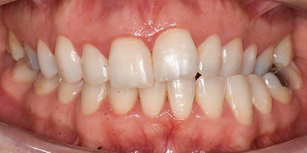 Before Image