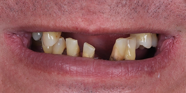 Before Image