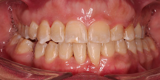 After Image