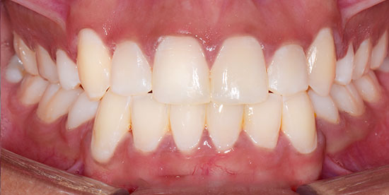After Image