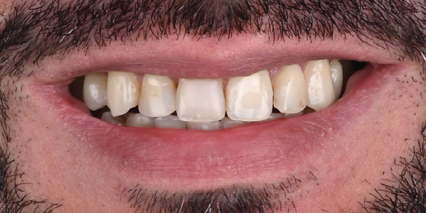 Before Image