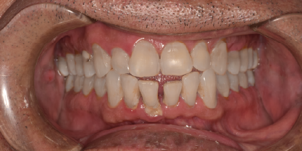 Before Image