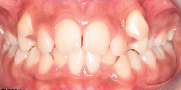 Before Image