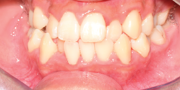 Before Image
