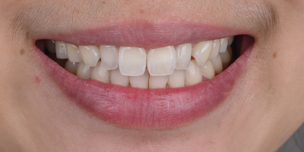 Before Image