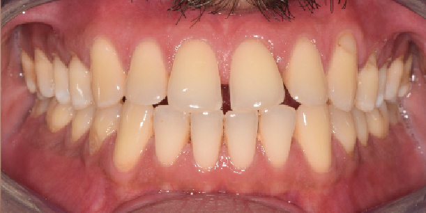 Before Image