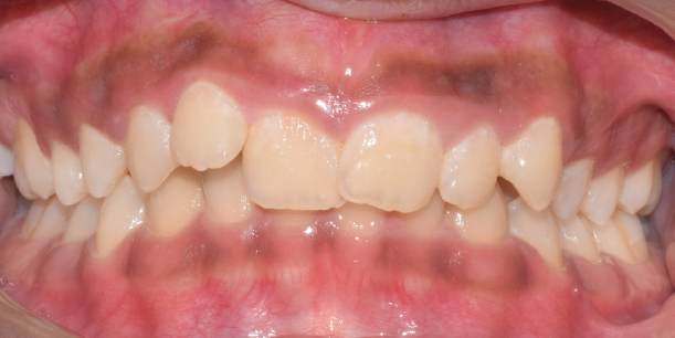Before Image