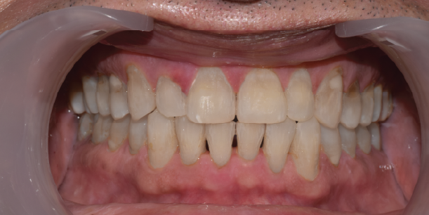 After Image