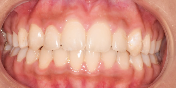 After Image