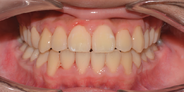 After Image