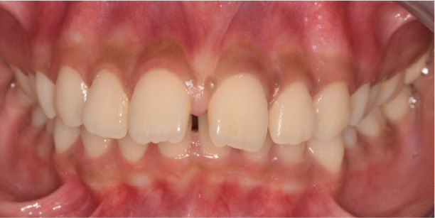 Before Image